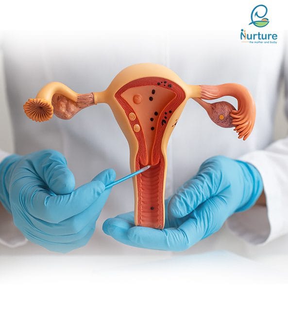 Nurture Hospital Bangalore providing expert maternity, IVF, fertility, and women’s healthcare services.